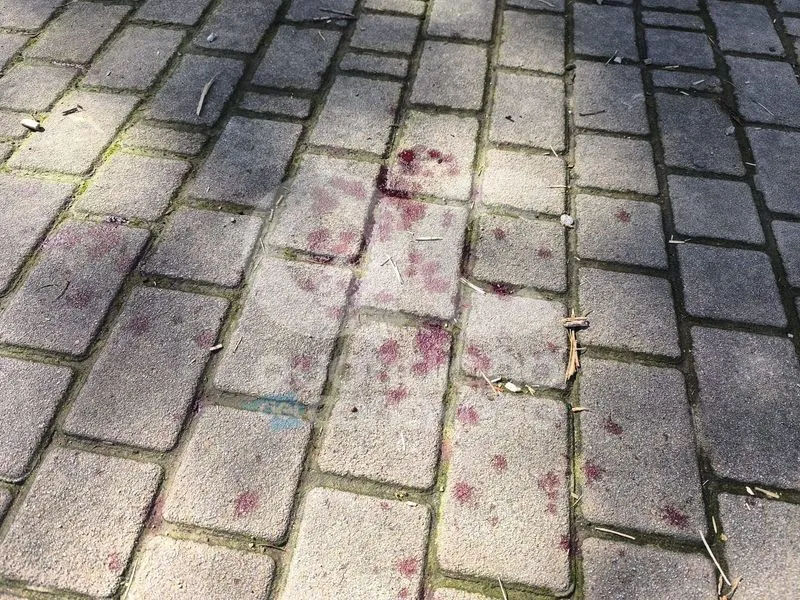 CUORGNE' - Botte tra ragazzini prima di entrare a scuola: minorenne ferito al volto finisce in ospedale - FOTO