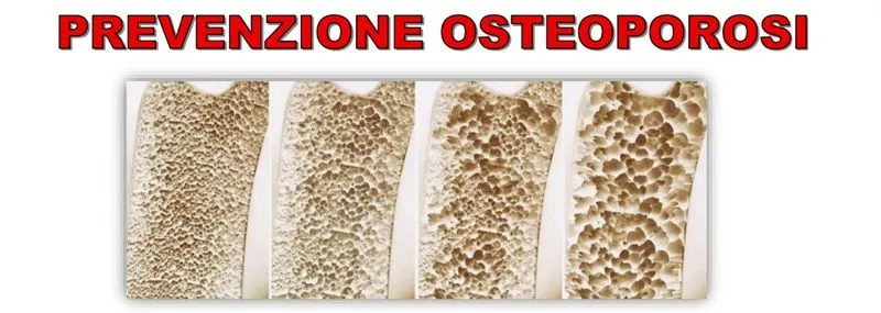 SAN GILLIO - In sala consiliare una serata dedicata all'osteoporosi con il Mutuo Soccorso e il dottor Simone Fenili