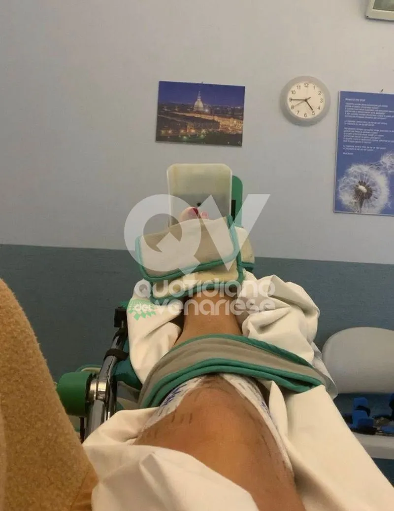 VENARIA - Cani senza guinzaglio cercano di aggredire un cane: padrona si frattura ginocchio e tibia per proteggerlo - FOTO
